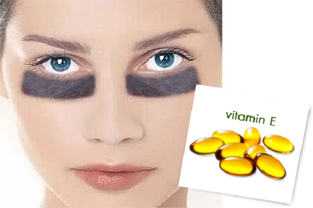 Cách dùng vitamin E giảm thâm quầng mắt hiệu quả 1