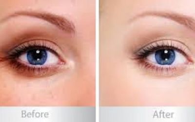 Brightest Eyes - Giảm nhăn và thâm quầng mắt sau 14 ngày với Eyes Peptide