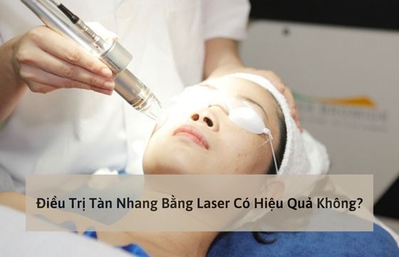 dieu-tri-tan-nhang-bang-laser-co-hieu-qua-khong