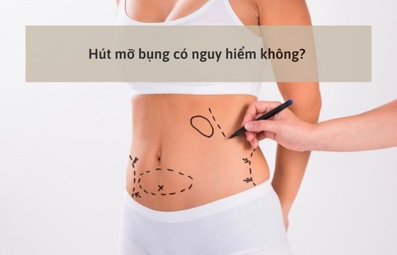 hut-mo-bung-co-nguy-hiem-khong